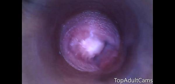  Endoscope Inside Pussy On Live Cam